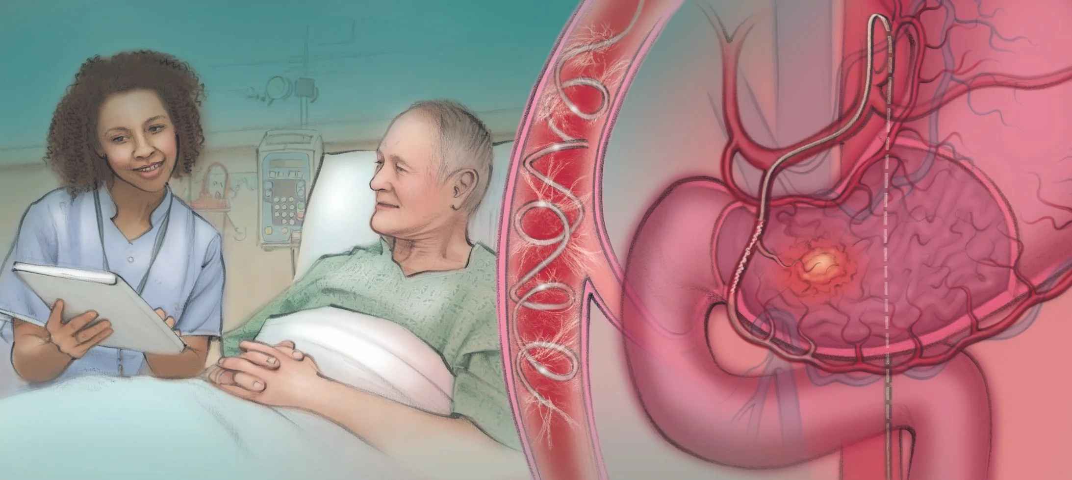 Bleeding Control Embolization