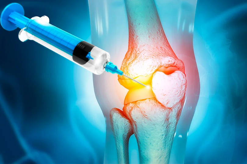 Joint Pain Procedures
