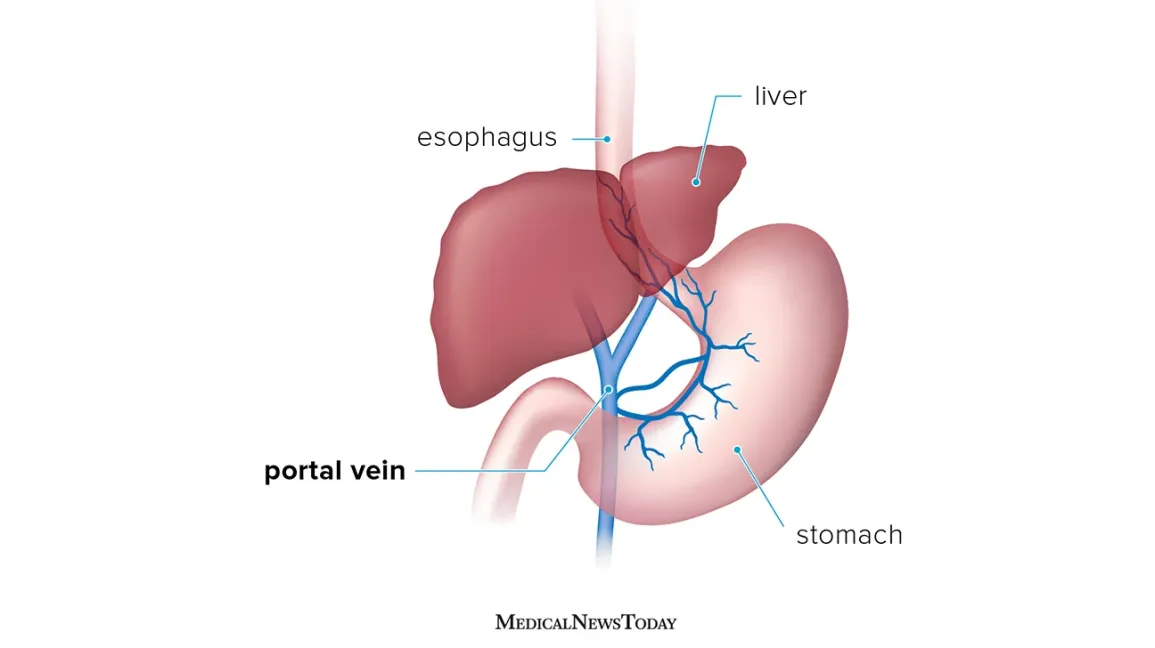 Portal Vein Interventions
