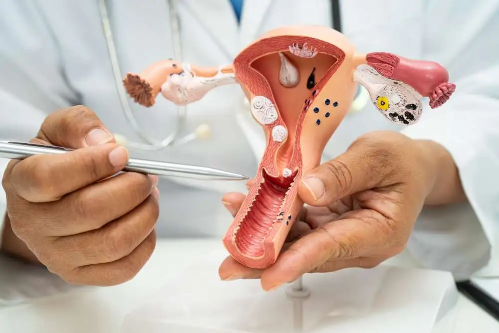 Uterine Fibroid Embolization